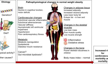 What is obesity?